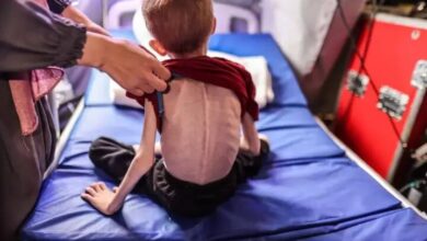 وزارت بهداشت غزه: ۶۵۰ هزار کودک در آستانه مرگ هستند