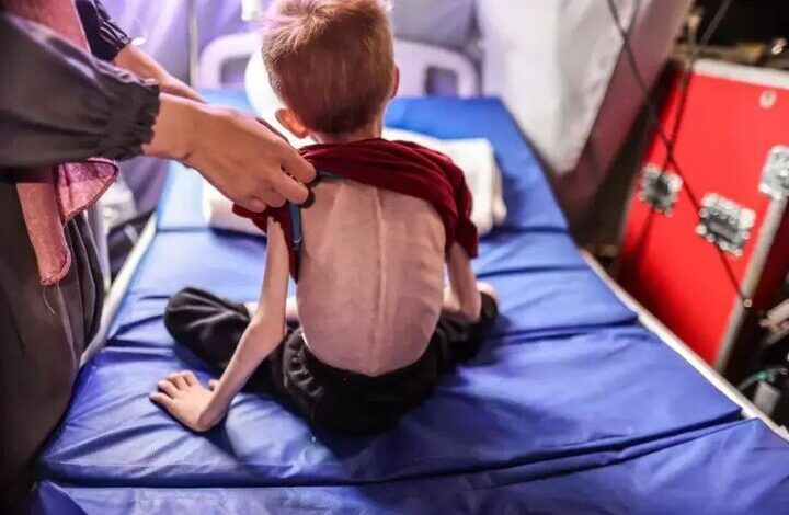 وزارت بهداشت غزه: ۶۵۰ هزار کودک در آستانه مرگ هستند
